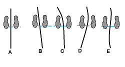 Typical croquet swing patterns. The Swing Coach II will confine your swing and coach you into the proper straight swing pattern. | Photo by Michael Rumbin